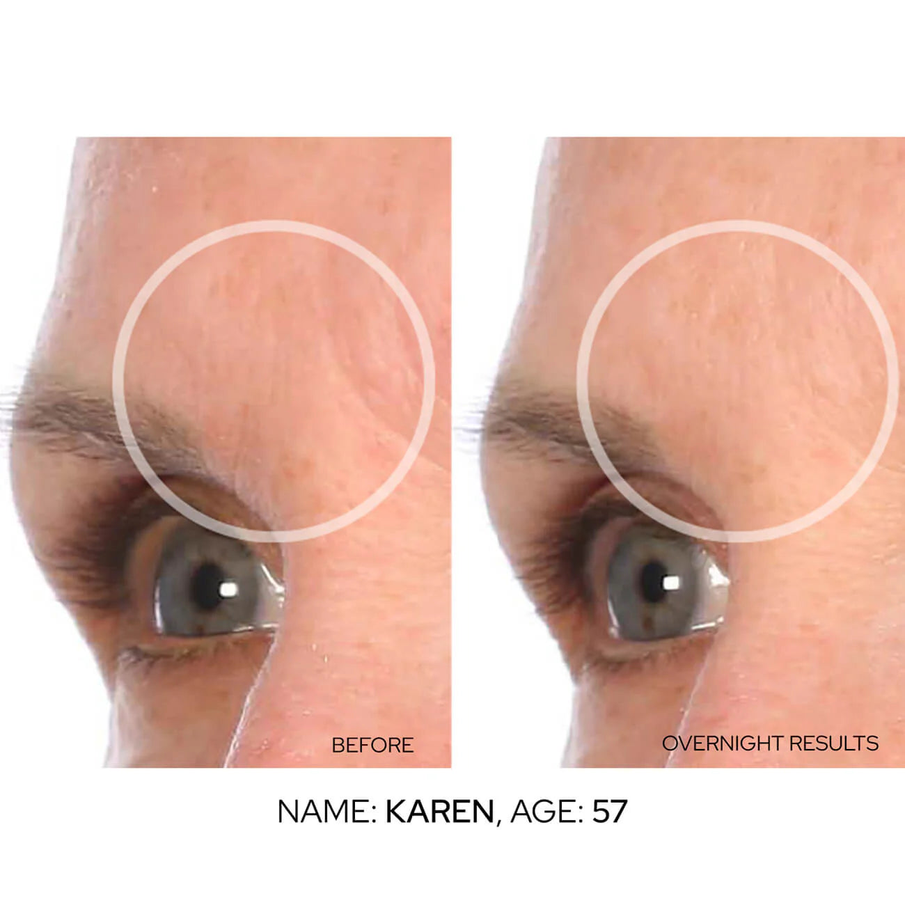 Anti-Aging Patch™, we Transform Your Skin from Home